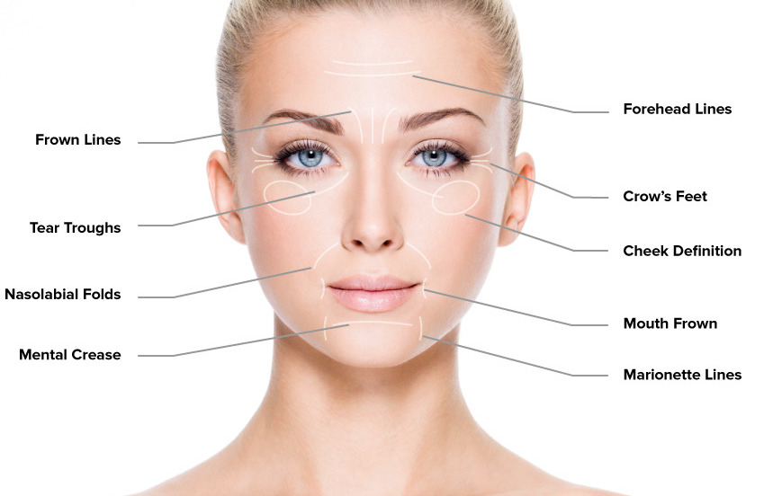 Fine Lines & Wrinkles Treatment