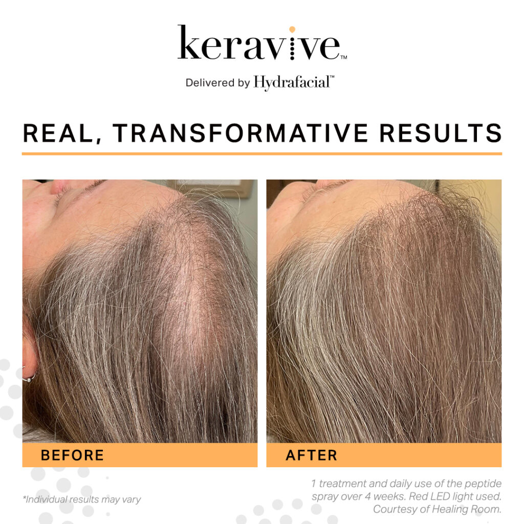 Keravive Study Results