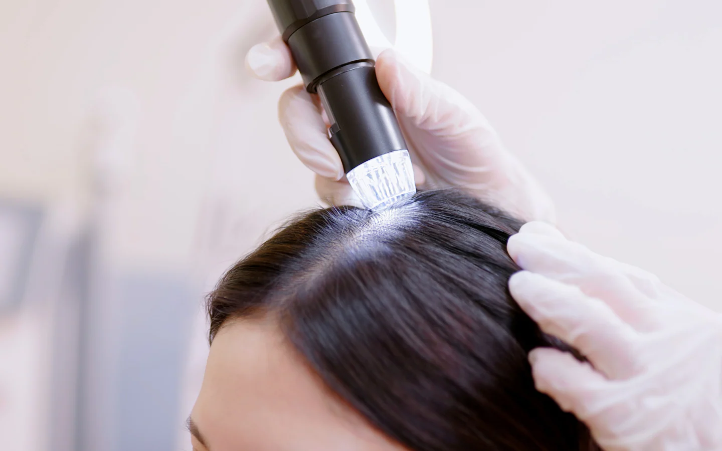 Scalp Treatments